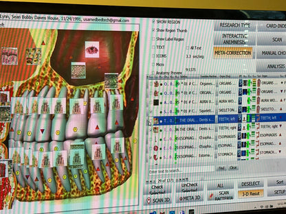 Computer screen displaying a dental model with digital labels and a software interface.