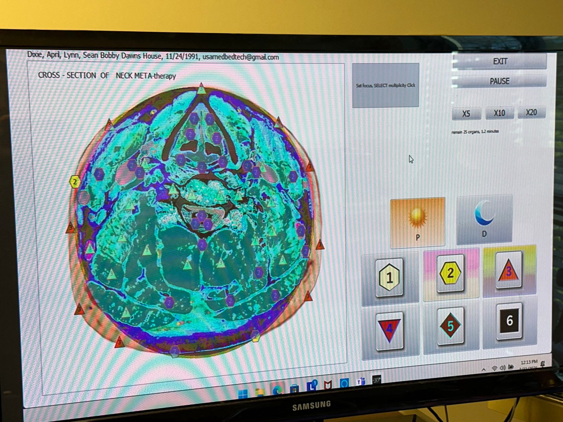 Computer screen displaying a medical imaging scan with various interface elements.