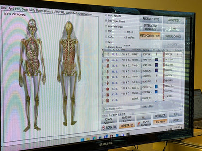 Computer screen displaying an anatomical skeleton model and software interface.