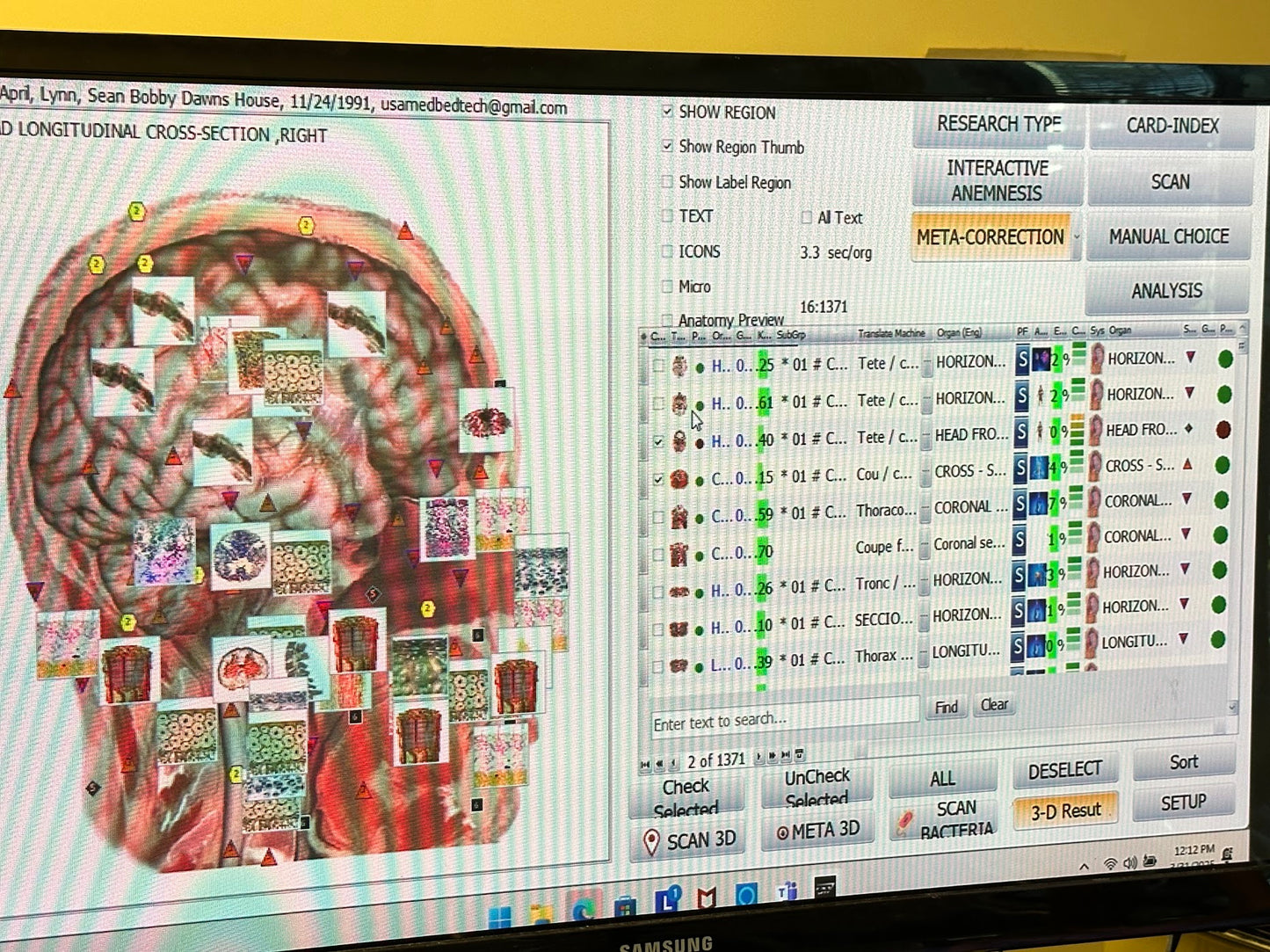 Computer screen displaying a brain imaging software with a brain scan on the left side.