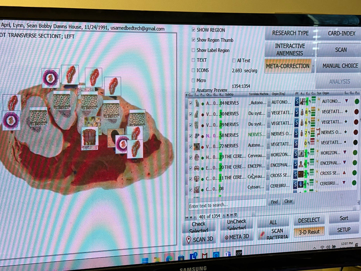 Computer screen displaying a medical imaging software interface with a brain scan and various tools and menus.