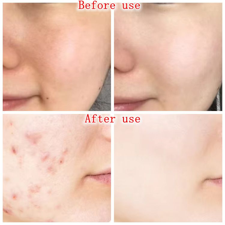 Red Light Beauty Mask - USA Med Bed